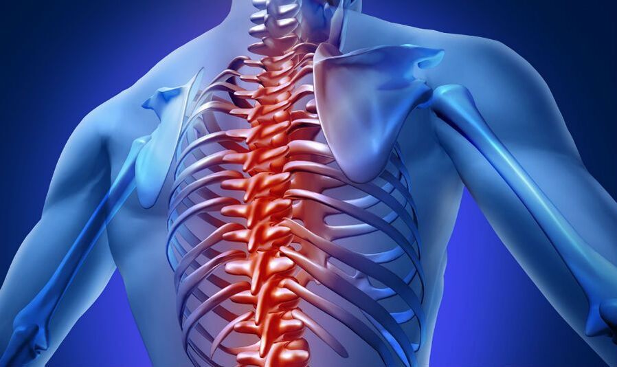 симптоми на гръдна остеохондроза
