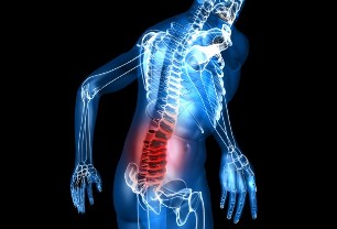 какво е остеохондроза на лумбалния гръбнак